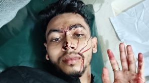 বাবুগঞ্জে জমি নিয়ে বিরোধে অন্তঃসত্ত্বা নারীসহ৩ জনকে পিটিয়ে জখম